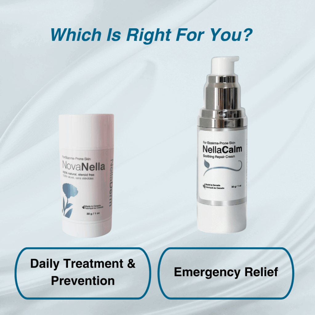 Eczema treatment balm and cream