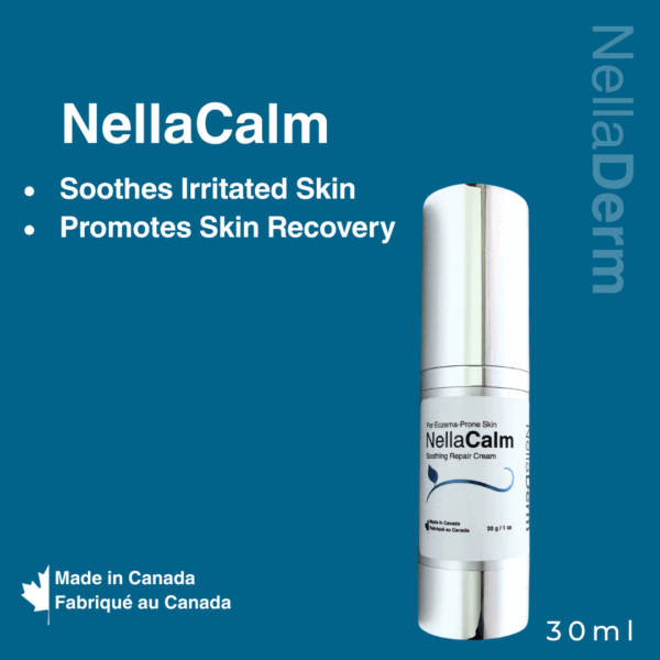 Best cream for treatment of eczema