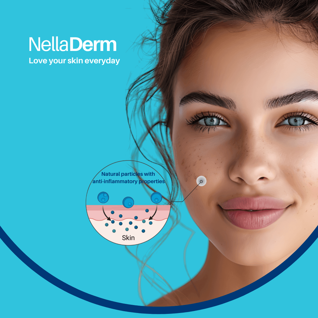 eczema treatment