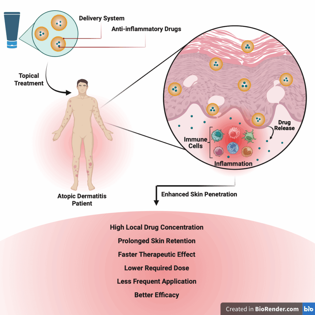 NellaDerm atopic dermatitis, Eczema research