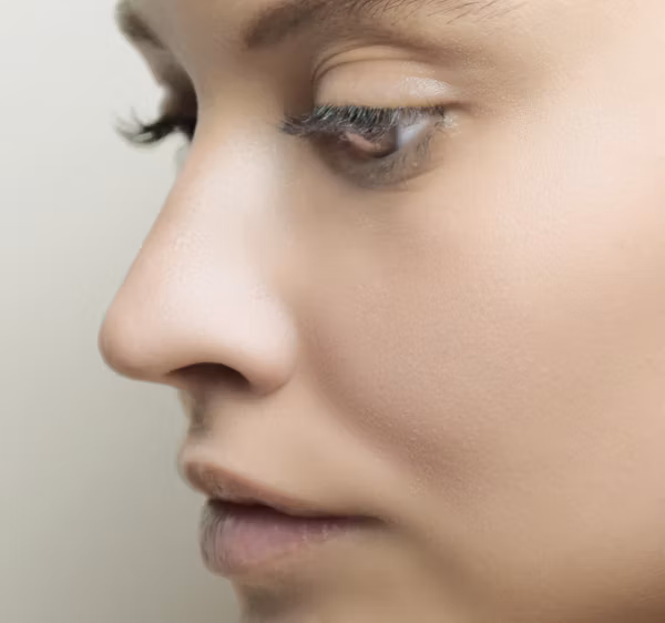 hyperpigmentation with eczema