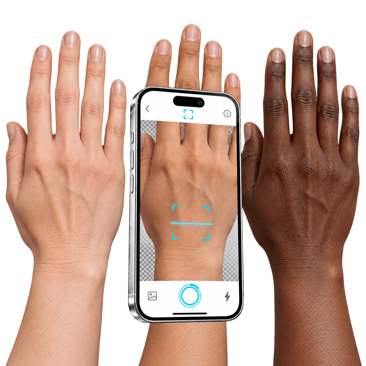 NellaDerm disease management and monitoring concept