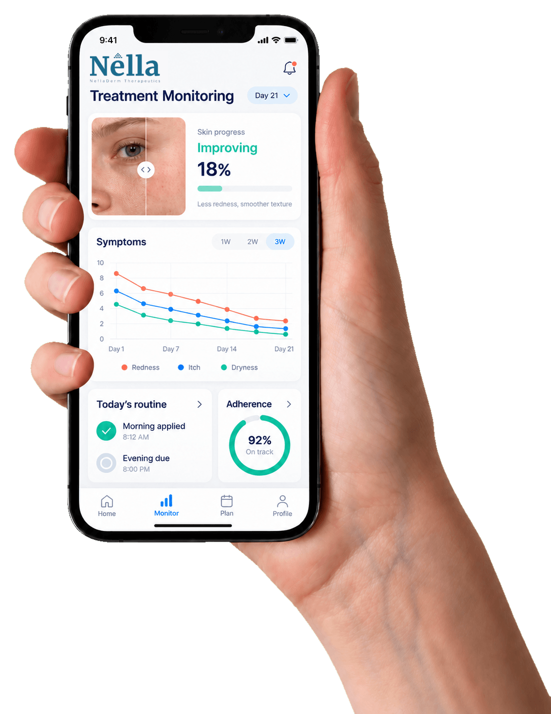 NellaDerm treatment response monitoring concept